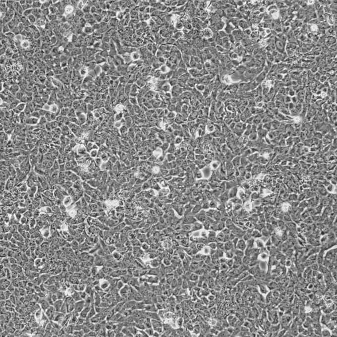 aml12细胞小鼠正常肝细胞