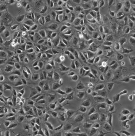 MFC细胞;小鼠前胃癌细胞