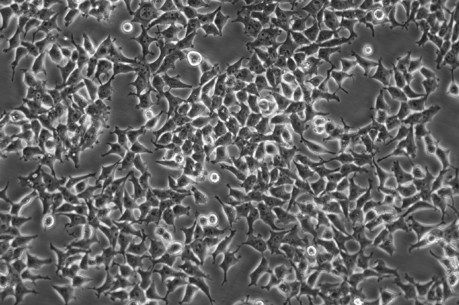 【热销】293T细胞；人胚肾细胞