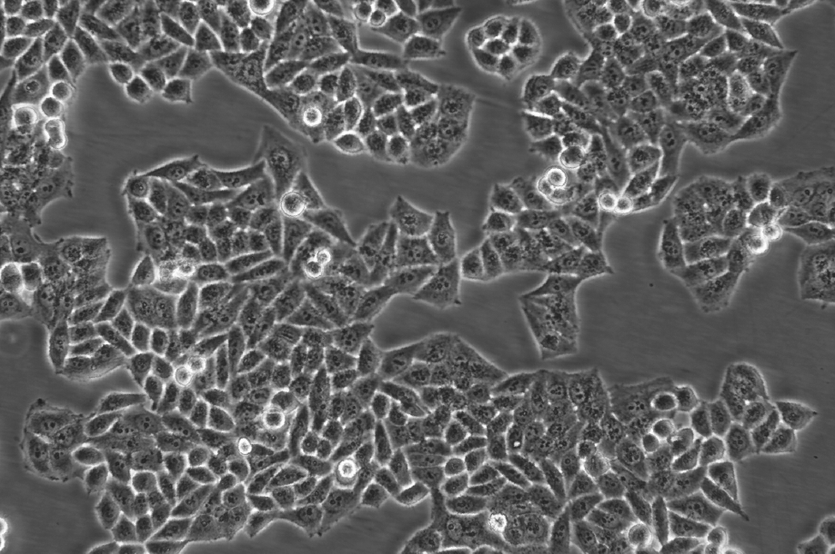 Hela细胞;海拉细胞;人子宫颈癌细胞