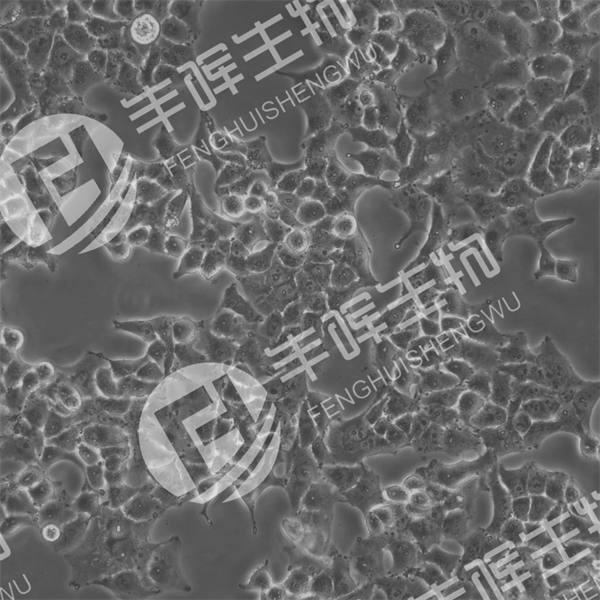 KYSE-70细胞（人食管鳞癌细胞）
