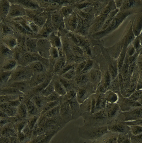 ARPE-19细胞;人视网膜上皮细胞