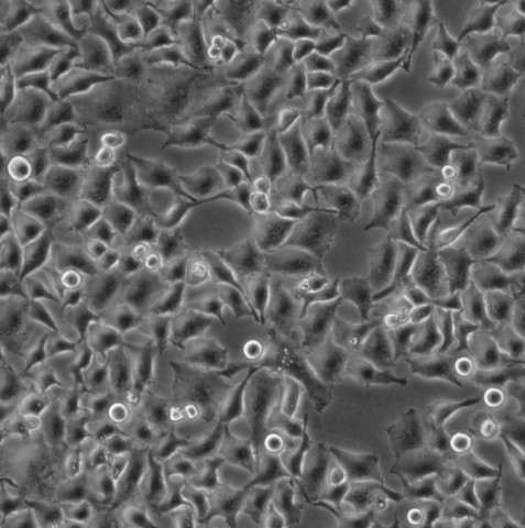 AV3 细胞;人乳头状瘤病毒相关性宫颈腺癌细胞