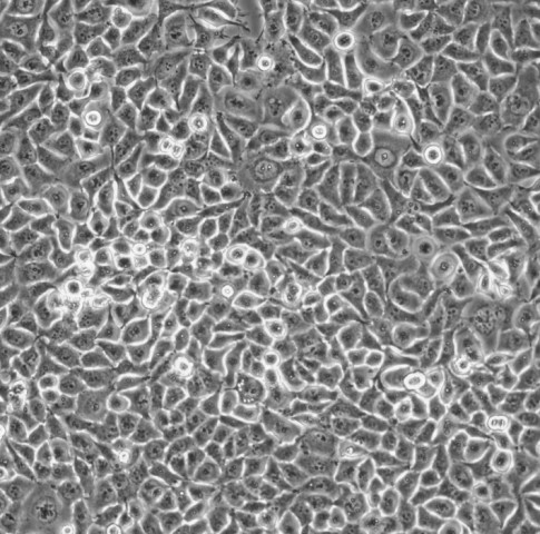 CNE-1细胞;人鼻咽癌细胞