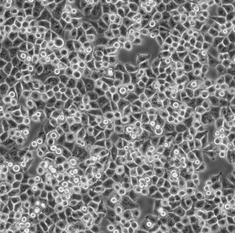 CNE-2细胞;人鼻咽癌细胞