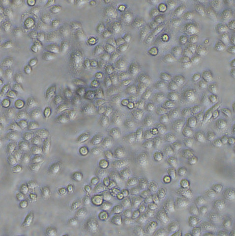 HO-8910PM细胞;高转移人卵巢癌细胞