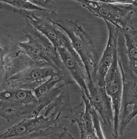 HAC细胞;人血管平滑肌脂肪瘤细胞