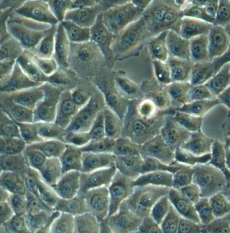 HNE1细胞;人鼻咽癌细胞