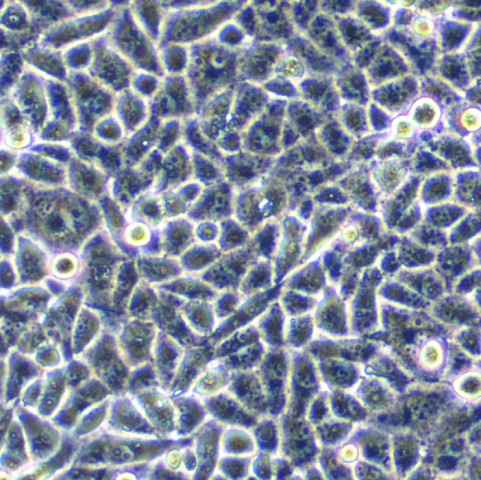 HO8910细胞;人卵巢癌细胞