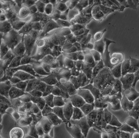 MHCC-97L细胞;人肝癌细胞