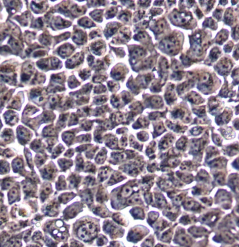 MZ-chA-1细胞;人胆管癌细胞