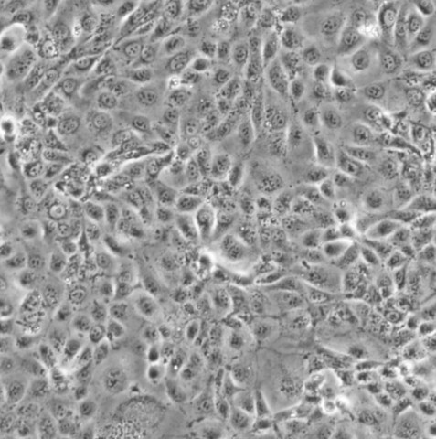 NCI-H3255细胞;人肺癌细胞