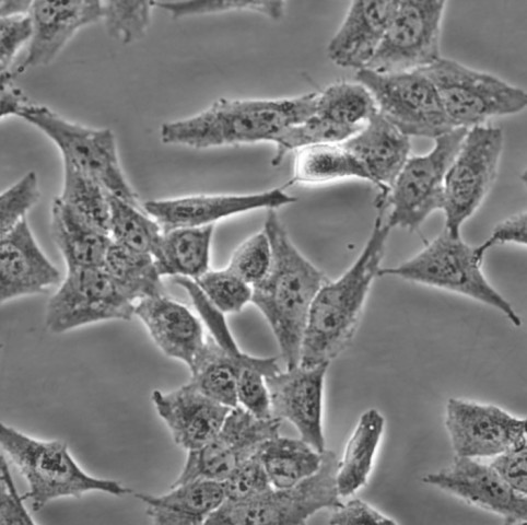 NCI-H446细胞;人小细胞肺癌细胞 