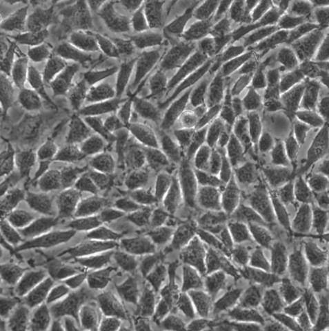 Bewo细胞;人胎盘绒膜癌细胞