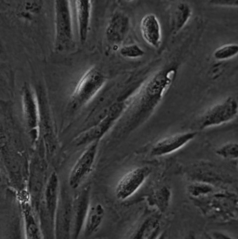 HSKMC细胞;人骨骼肌细胞