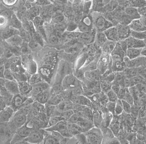 HTEPT-RPE1细胞;人永生化视网膜色素上皮细胞系