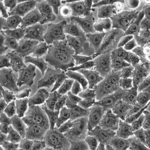 IOSE-29细胞;人正常卵巢上皮细胞