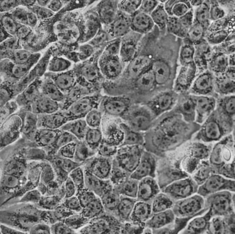 FHL124细胞;人晶状体上皮细胞