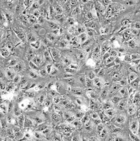 ACHN细胞;人肾细胞腺癌细胞