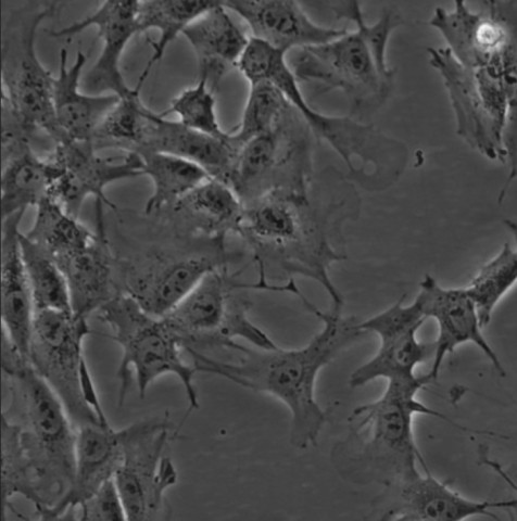 ST细胞;猪胎睾丸细胞