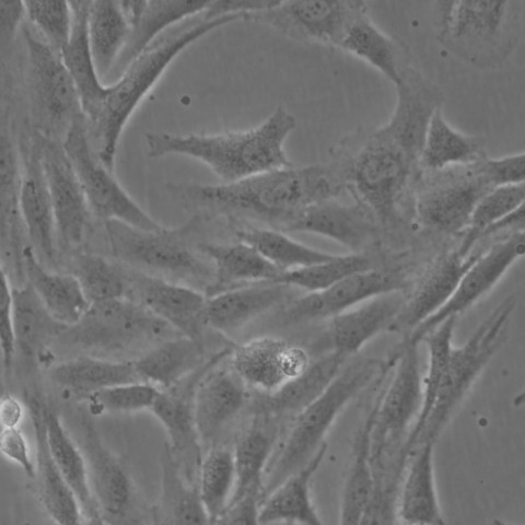 SW982细胞;人滑膜肉瘤细胞