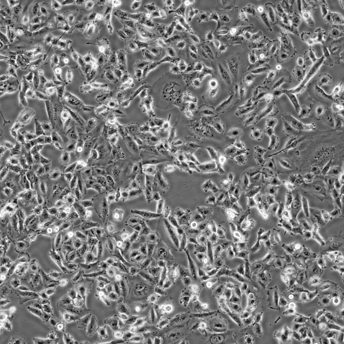 MDA-MB-231+lucxib ;人乳腺癌细胞luc稳转株