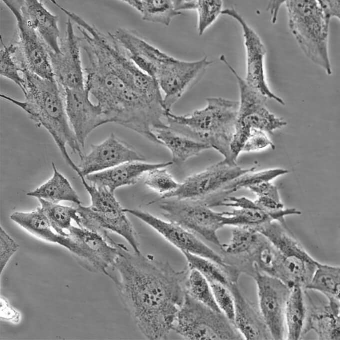 MRC-5 细胞;人胚肺成纤维细胞