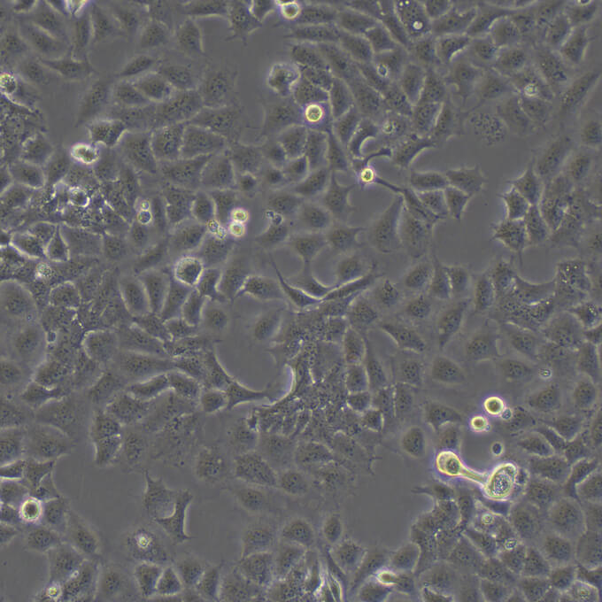 Tu686细胞;人喉癌细胞