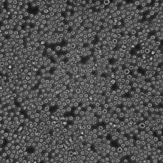 NALM-6细胞;人急性淋巴细胞白血病细胞