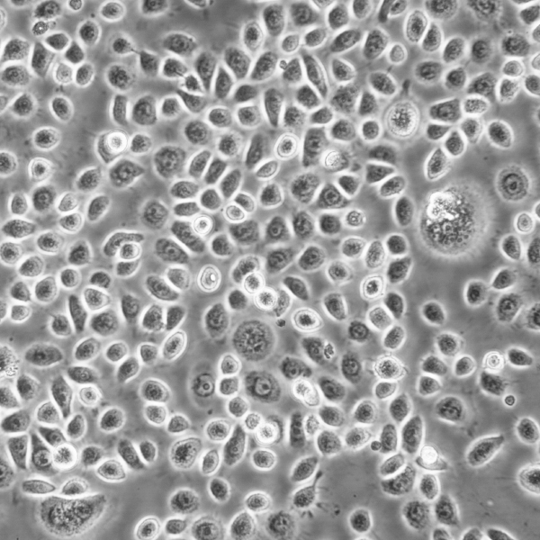 ME-180细胞;人子宫颈表皮癌细胞