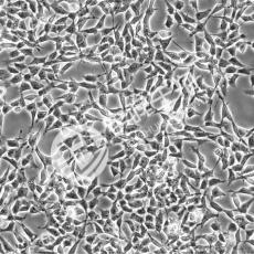 IMR-32细胞;人神经母细胞瘤细胞