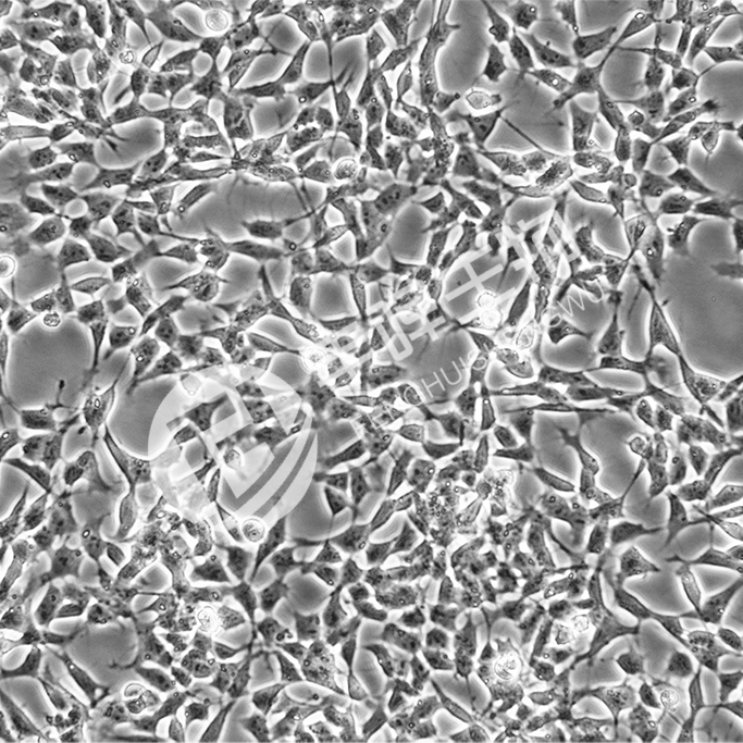 IMR-32细胞;人神经母细胞瘤细胞