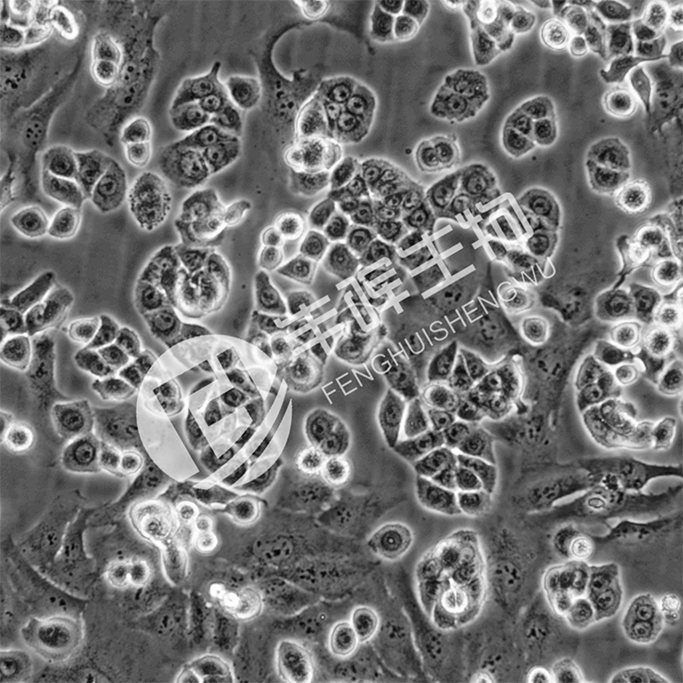 C4-2B细胞;人前列腺癌细胞