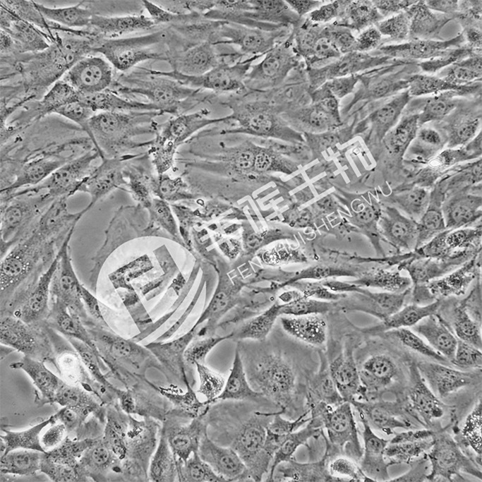 BALB/C3T3 细胞;小鼠胚胎成纤维细胞