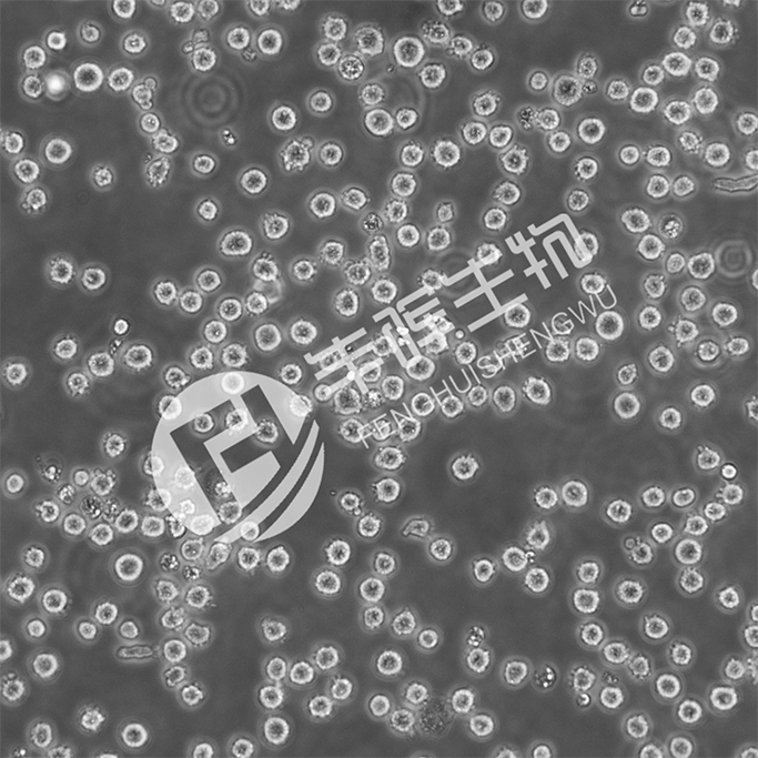 CCRF-CEM细胞（人急性淋巴细胞白血病T淋巴细胞）