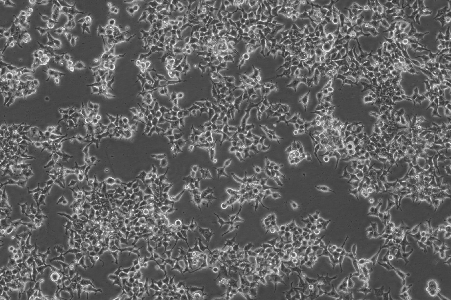 COLO 205细胞;人结直肠腺癌细胞
