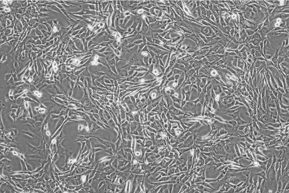 MEF细胞;小鼠胚胎成纤维细胞