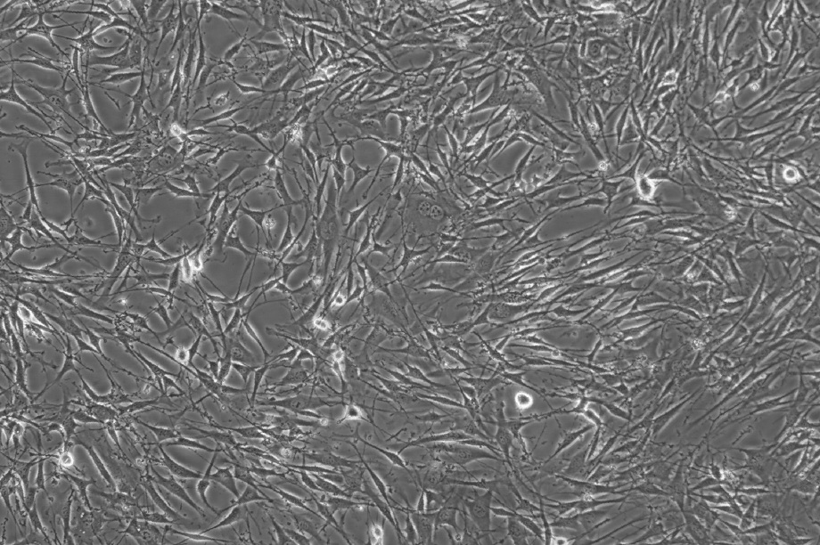 op9细胞;小鼠骨髓基质细胞