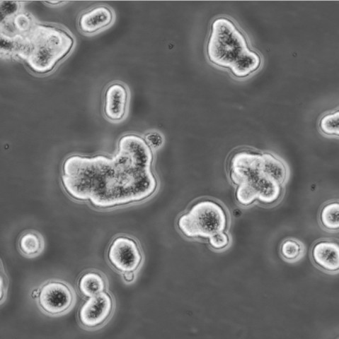 HCC1187细胞;人乳腺导管癌细胞