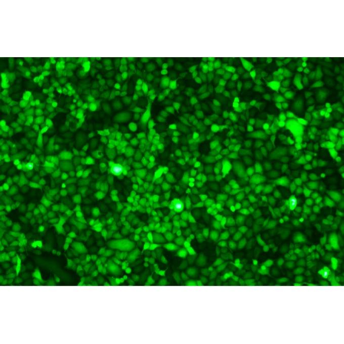 Hela-GFP细胞;人子宫颈癌细胞绿色荧光株