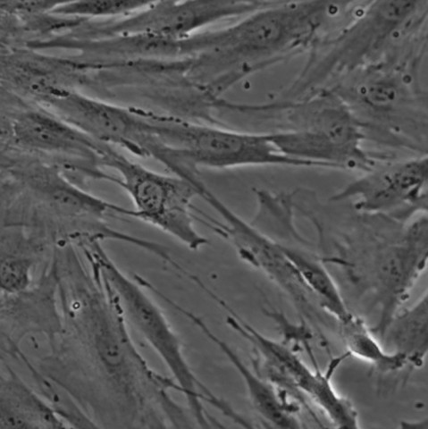 HFF-1细胞（人包皮成纤维细胞human foreskin fibroblasts）