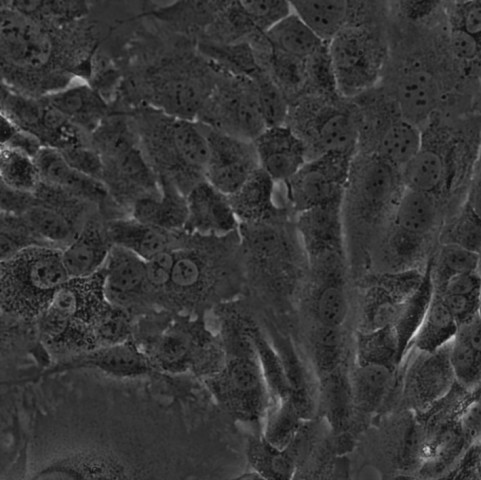 SIRC细胞;兔角膜上皮细胞