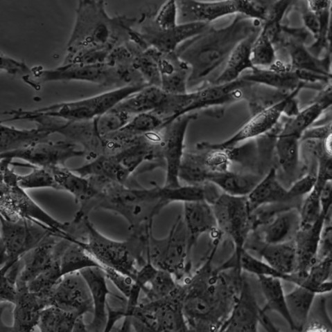 HRMC细胞;人肾小球系膜细胞