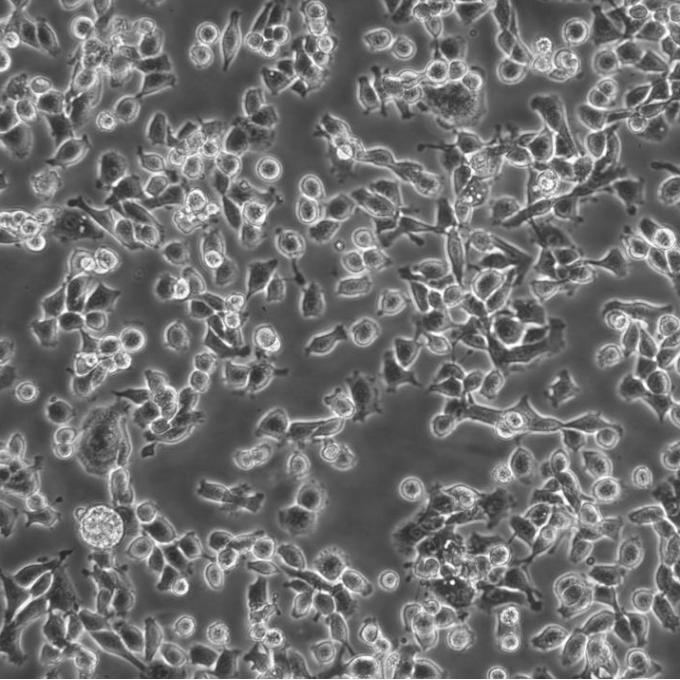 MC38细胞;小鼠结肠癌细胞