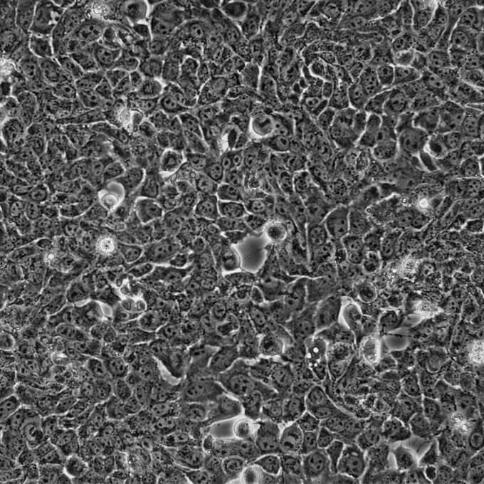 AML12细胞;小鼠正常肝细胞