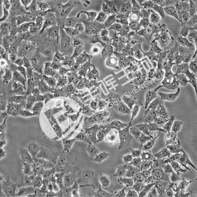 Ishikawa细胞;人子宫内膜癌细胞