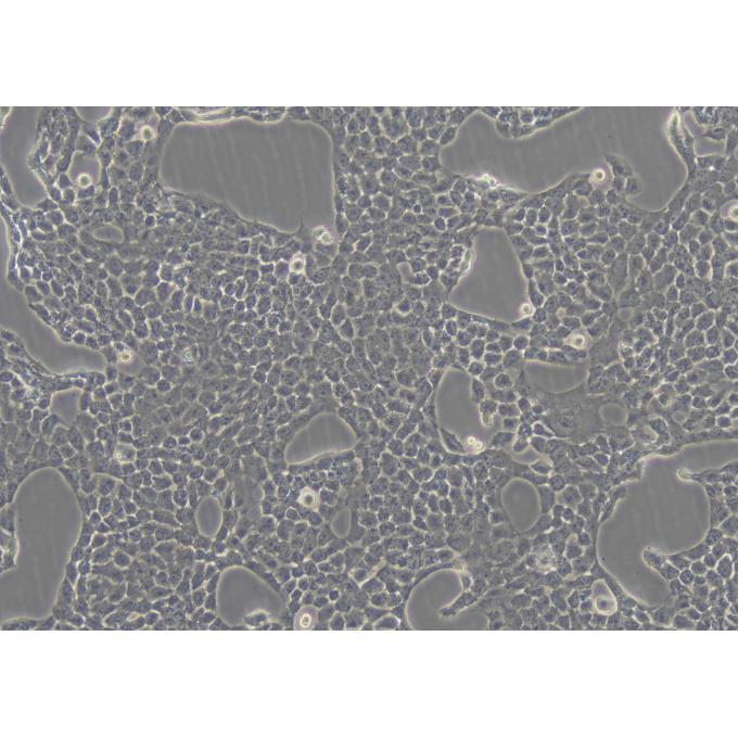 Cal-27-mCherry