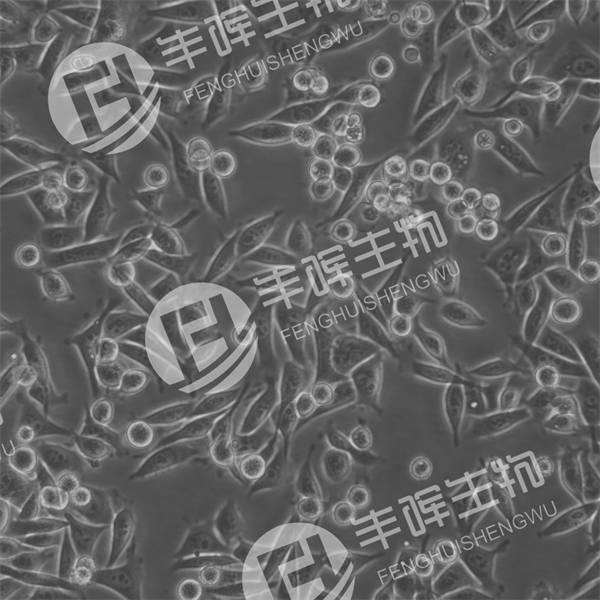 KYSE-30细胞（人食管鳞癌细胞）