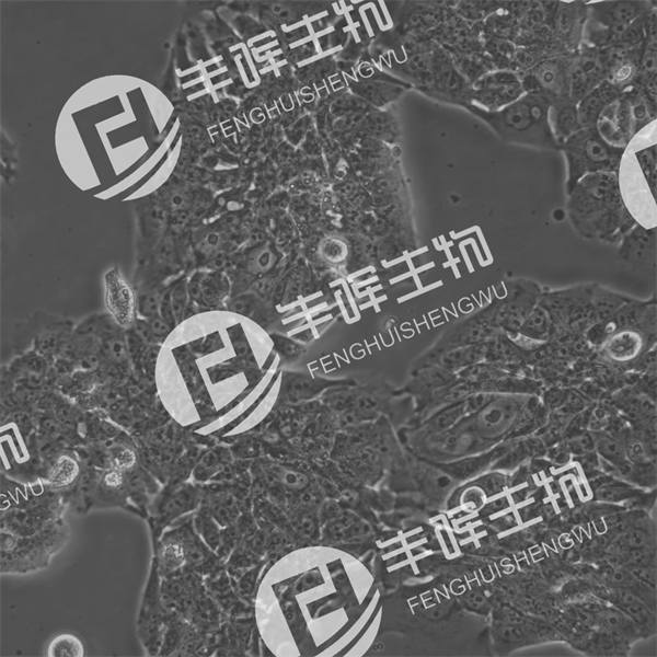 NCI-H358细胞（人非小细胞肺癌细胞）