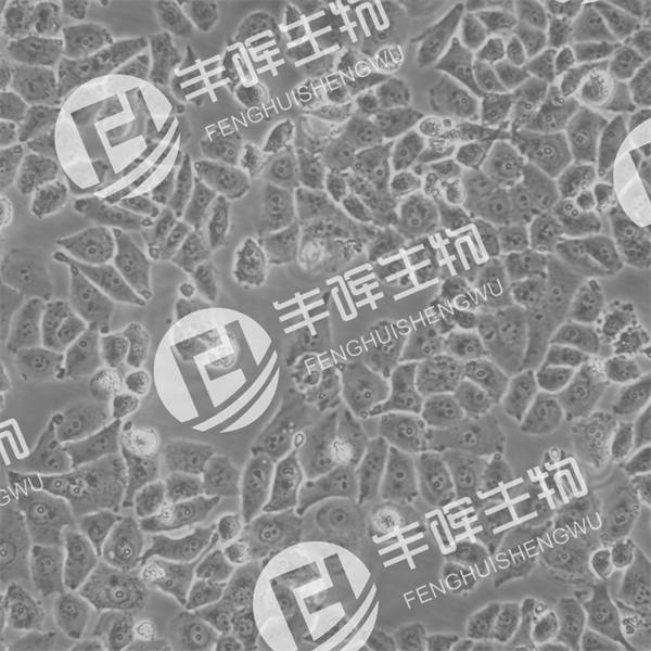 Ntera-2细胞（人恶性多发性畸胎瘤细胞）